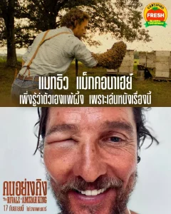 “แม็กคอนาเฮย์” โดนผึ้งต่อยหน้าบวมฉึ่ง!